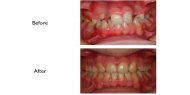 Specialist Orthodontist Now Available at Bright Smile Dental Clinic