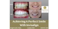 Achieving A Perfect Smile With Invisalign - Bright Smile Dental Clinic