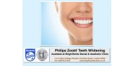 Philips ZooM! Teeth Whitening Available at BrightSmile Dental & Aesthetic Clinic NW3