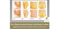 Transform Your Body: The Incredible Benefits of Fat Dissolving Treatments - Bright Smile Clinic NW3